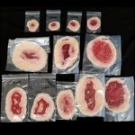 Small Self-Adhesive Wound Kit