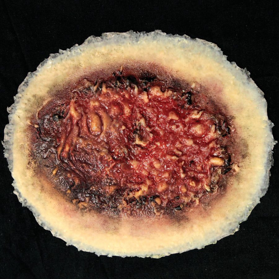 didele-terminio-nudegimo-imitacija.jpg Thermal Burn, Large - Image 1