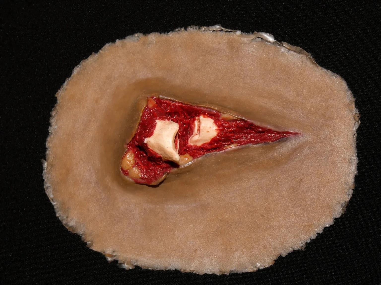 luzio-imitacija.jpg Fracture Wound - Image 1